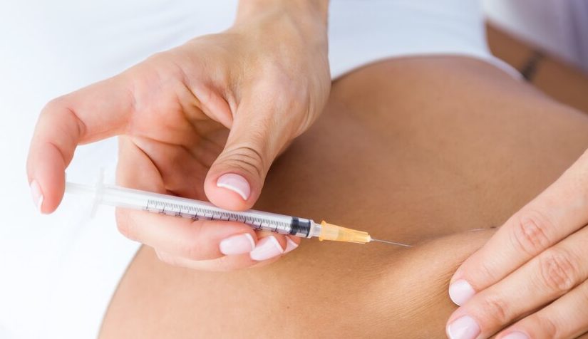 ¿Qué es la mesoterapia abdominal y en qué consiste?